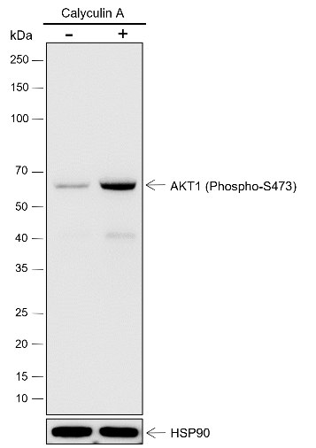Anti-Phospho-AKT1 (Ser473) Rabbit mAb