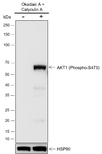 Anti-Phospho-AKT1 (Ser473) Rabbit mAb