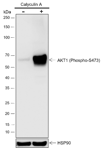 Anti-Phospho-AKT1 (Ser473) Rabbit mAb