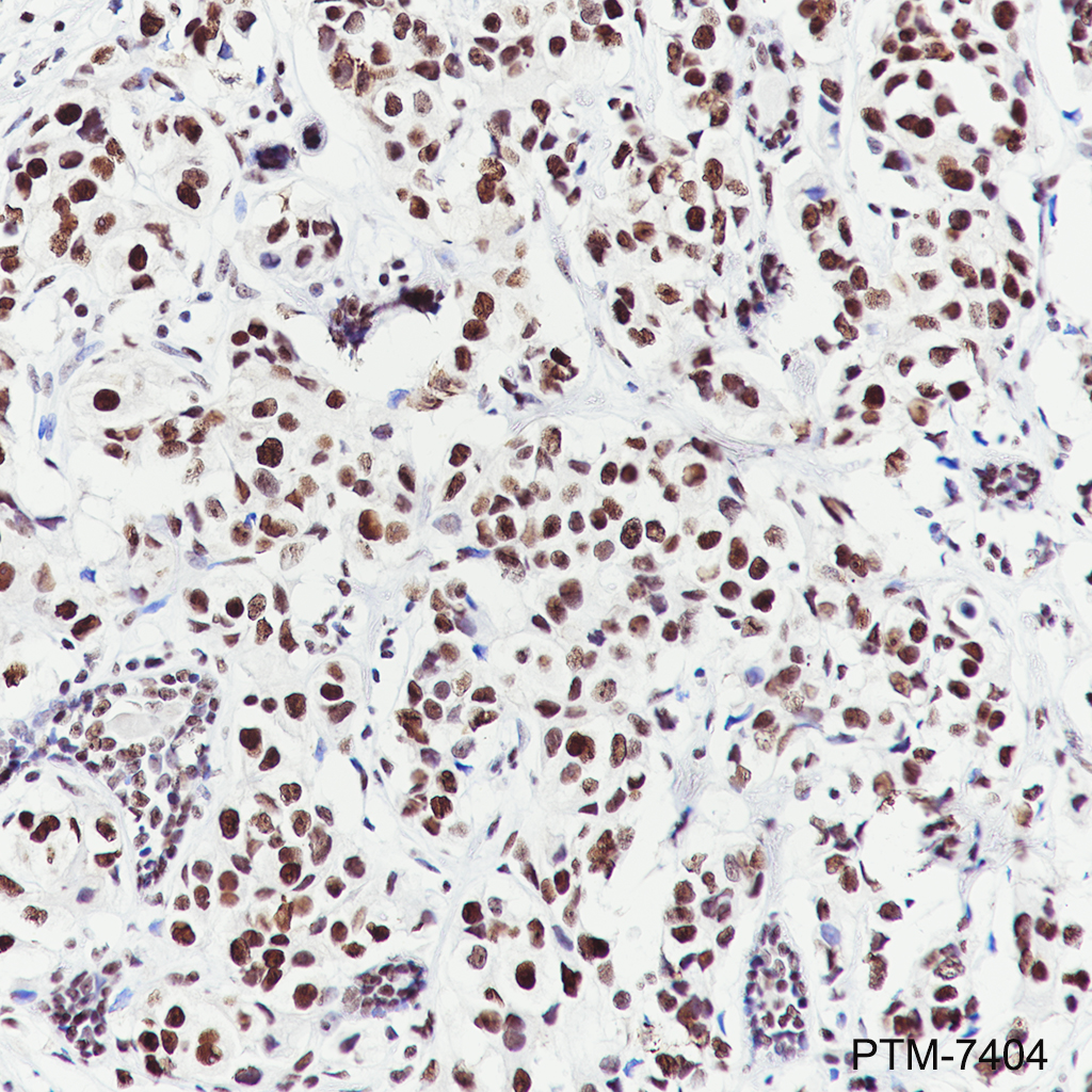 Anti-MORF4L2 Rabbit mAb