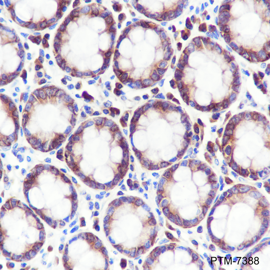 Anti-FARSA Mouse mAb
