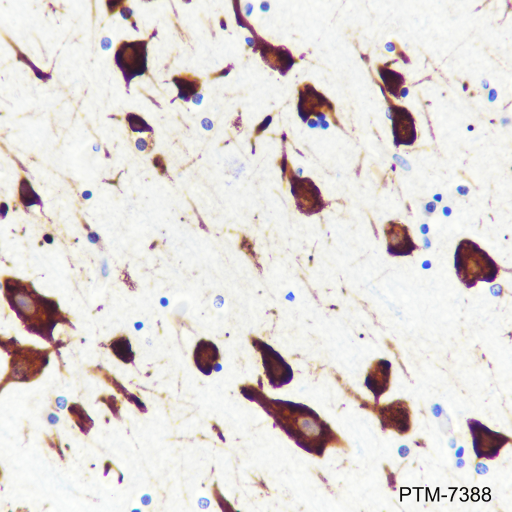 Anti-FARSA Mouse mAb