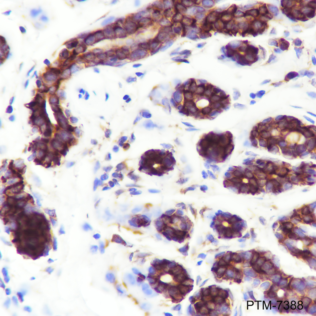 Anti-FARSA Mouse mAb