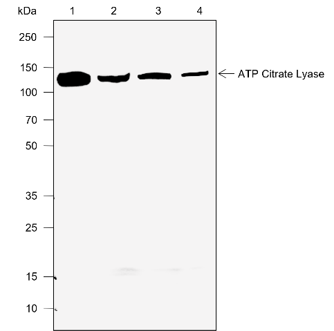 Anti-ATP Citrate Lyase Rabbit mAb