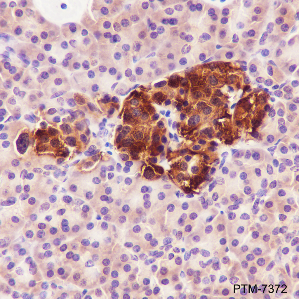 Anti-ATP Citrate Lyase Rabbit mAb