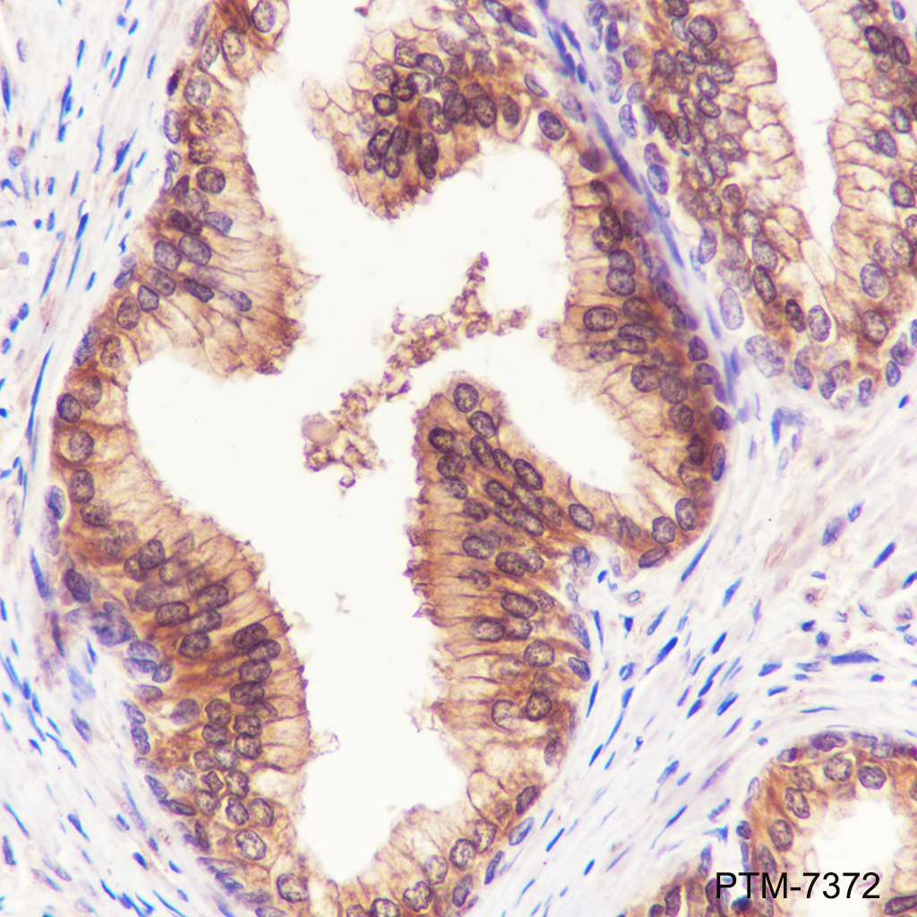 Anti-ATP Citrate Lyase Rabbit mAb