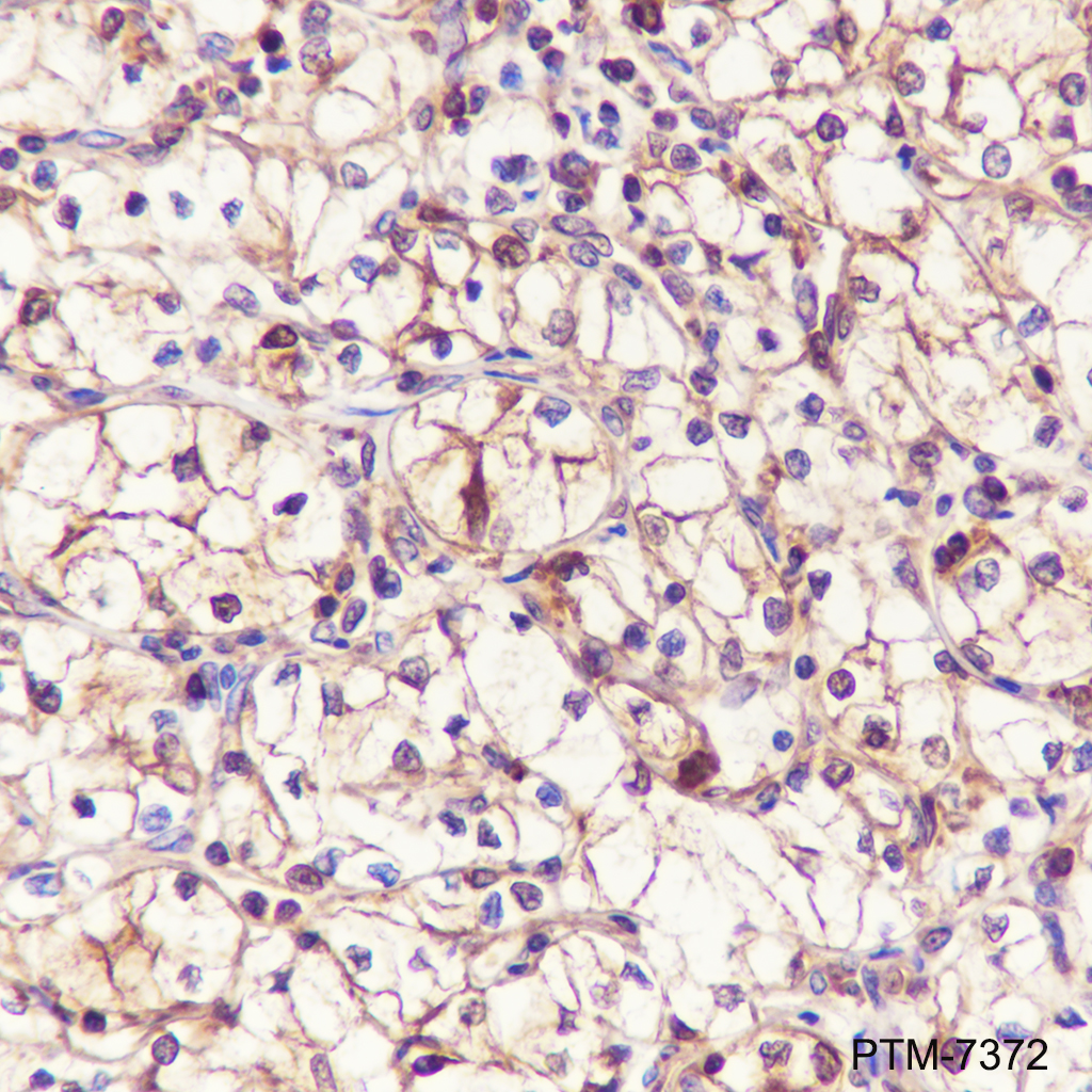 Anti-ATP Citrate Lyase Rabbit mAb