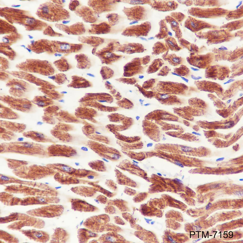 Anti-MYH7 Rabbit mAb