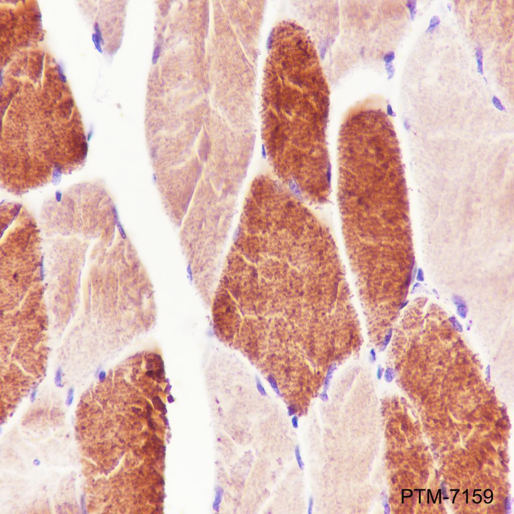 Anti-MYH7 Rabbit mAb