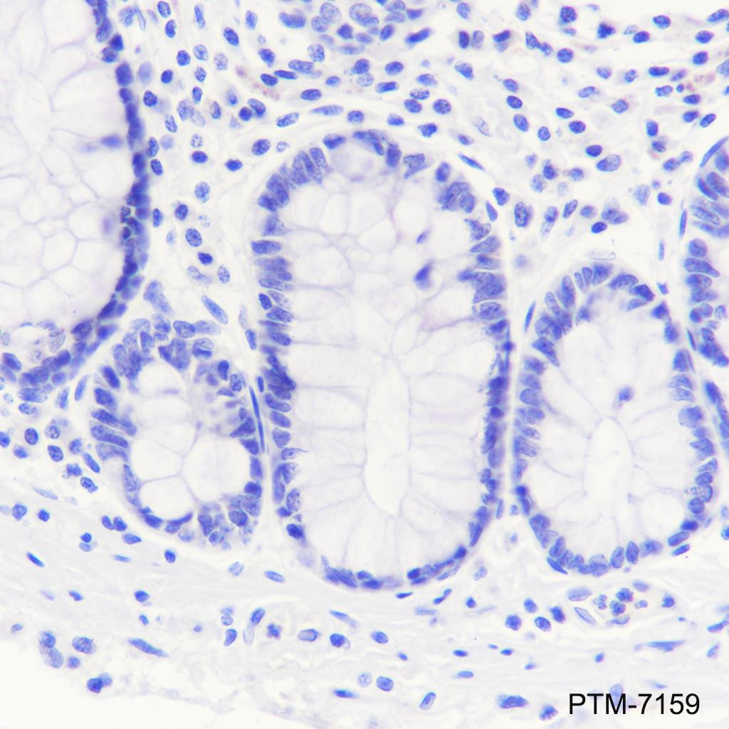 Anti-MYH7 Rabbit mAb