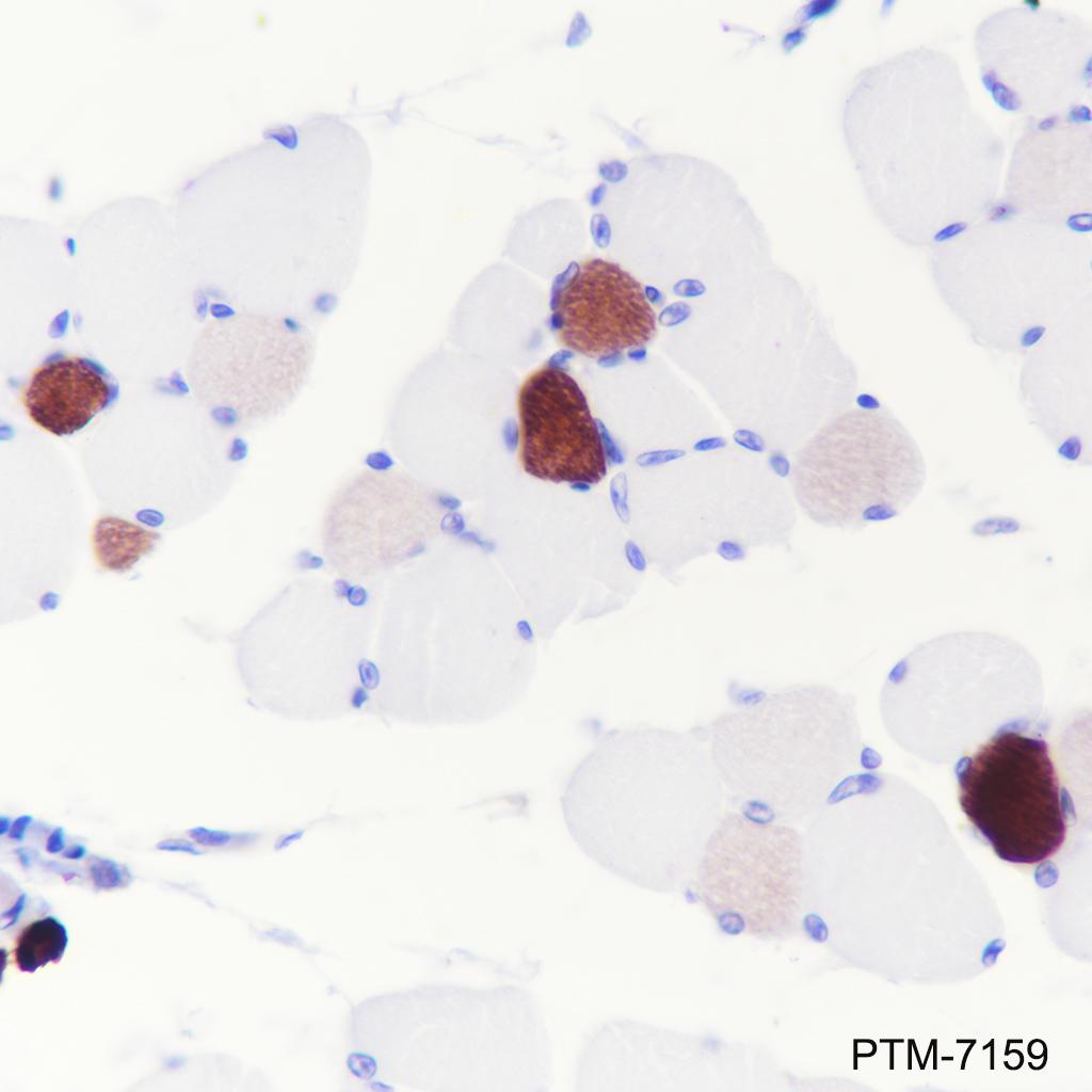 Anti-MYH7 Rabbit mAb