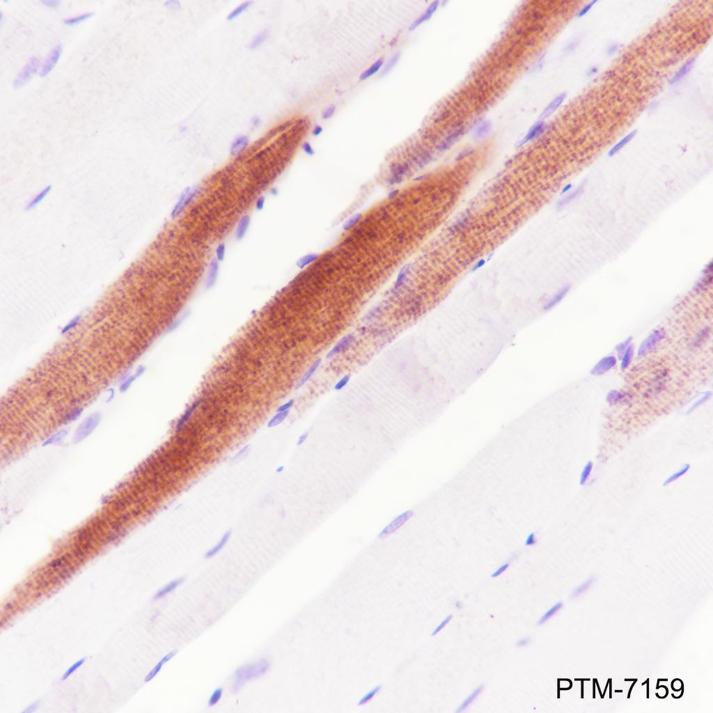 Anti-MYH7 Rabbit mAb