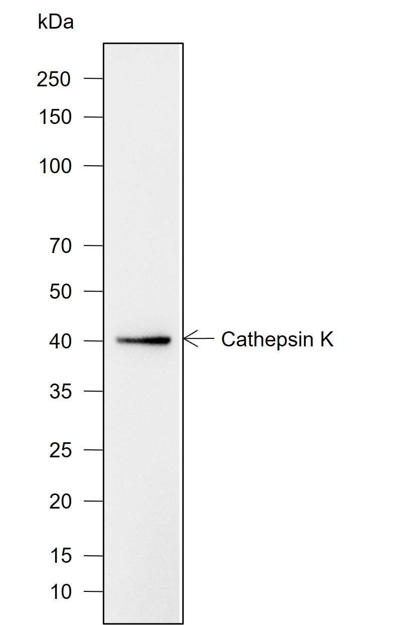 Anti-Cathepsin K Mouse mAb