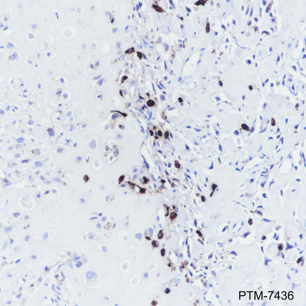 Anti-Cathepsin K Mouse mAb