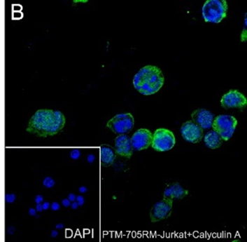 Anti-Phosphothreonine Rabbit mAb