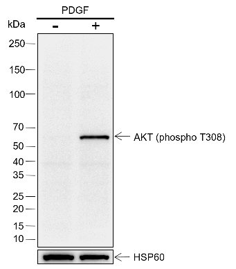 Anti-Phospho-AKT (Thr308) Rabbit mAb