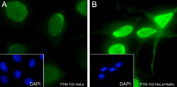 Anti-Acetyllysine Mouse mAb