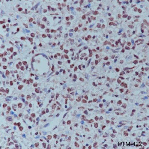 Anti-Succinyl-Histone H3 (Lys23) Mouse mAb