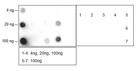 Anti-Butyryllysine Rabbit mAb