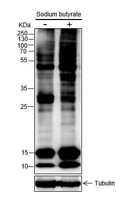 Anti-Butyryllysine Rabbit mAb