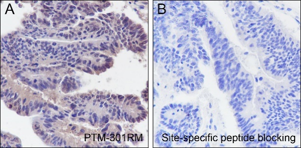 Anti-Butyryllysine Rabbit mAb