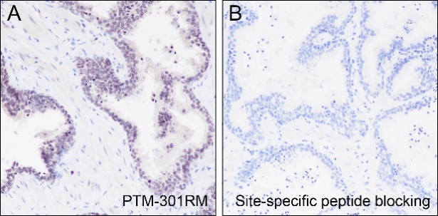 Anti-Butyryllysine Rabbit mAb
