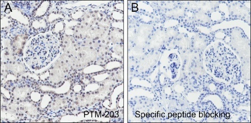 Anti-Propionyllysine Mouse mAb