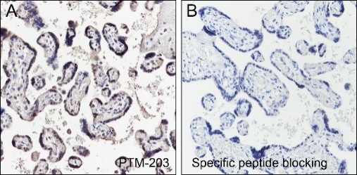 Anti-Propionyllysine Mouse mAb